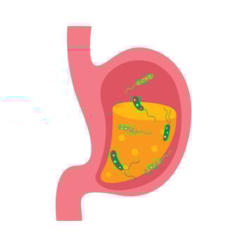 vibrio cholera bacteria infection disease concept. stomach vector