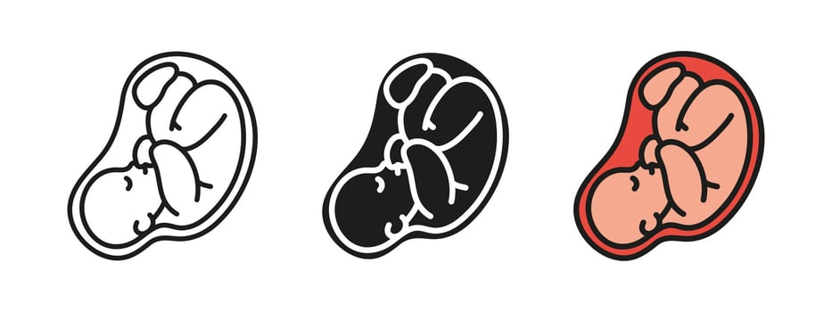 Fetus icon. Human embryo illustration. Pregnancy and motherhood symbol. Unborn baby child infant sign. Ultrasound pictogram. Uterus or womb germ silhouette. Childbirth and reproduction concept. vector