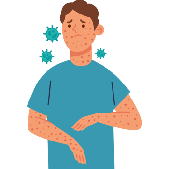 male character with monkeypox virus png