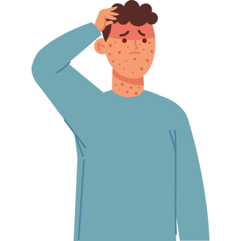 sick young with monkeypox png