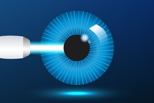 Eye with glaucoma, medical infographics with the anatomy of the human eye optics. Laser eye surgery LASIK vector