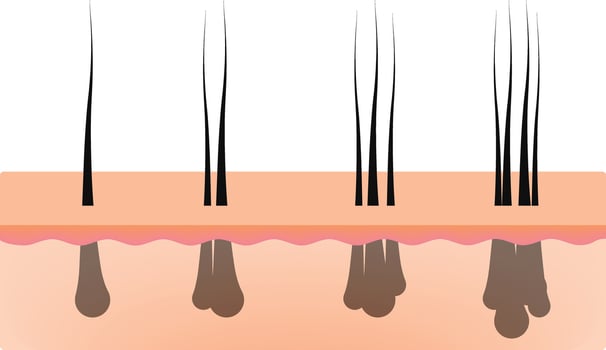 Hair Follicle Anatomy Design Illustration vector