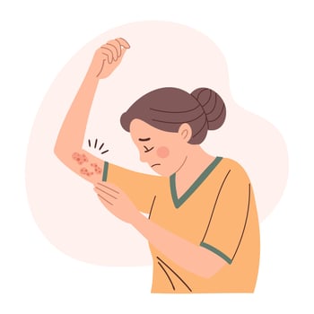 Woman with itchy skin rash. Allergic itching, skin inflammation, redness and irritation. Healthcare and medicine. vector