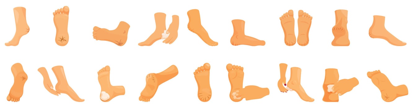 Cracked heels icons set. Feet applying cream or suffering from dry skin, blisters and calluses vector