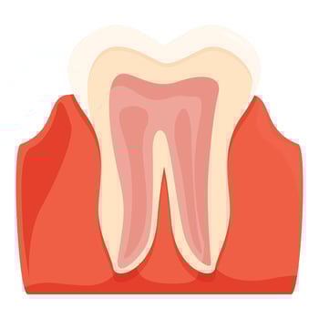Periodontitis affecting human tooth and causing gum inflammation vector