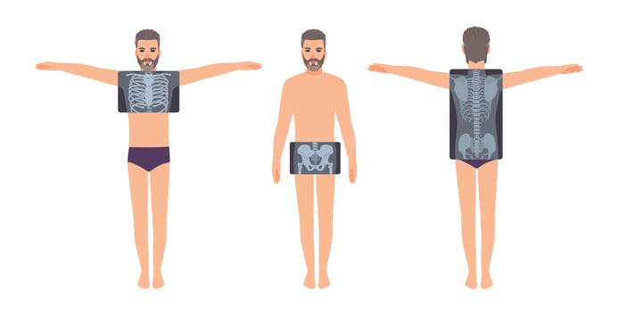 Male patient and his chest, pelvis and back radiograph isolated on white background. Bearded man and X-ray pictures of his skeletal system on monitor. Flat cartoon colorful illustration. vector