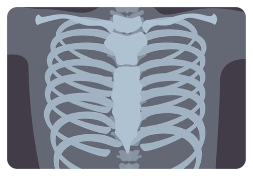 Radiograph, X-radiation picture or X-ray image of rib or thoracic cage formed by vertebral column and sternum. Medical radiography and human skeletal system. Flat monochrome illustration. vector