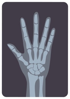 Radiograph, X-radiation picture or X-ray image of hand or palm with wrist and fingers. Modern medical radiography and human skeletal system. Monochrome illustration in flat cartoon style. vector