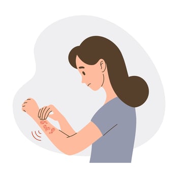 Woman with itchy skin rash. Allergic itching, skin inflammation, redness and irritation. Healthcare vector