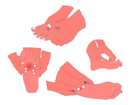 A set of illustrations of various foot health problems, designed with medical details yet aesthetic and easy to understand. for educational materials, medical presentations, or health content design. vector