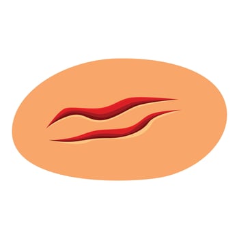 Surgical wound showing scar tissue healing on skin vector