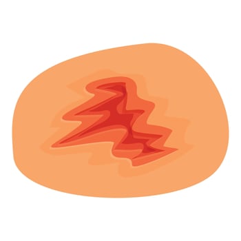 Skin damage showing scar tissue forming a zigzag pattern vector