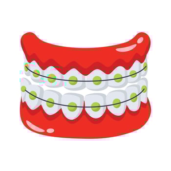 Dental braces for teeth alignment and orthodontic treatment vector