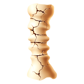 Detailed Illustration of an Cracked Bone Structure png