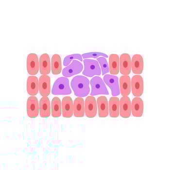 cancer growth. cancer disease concept vector