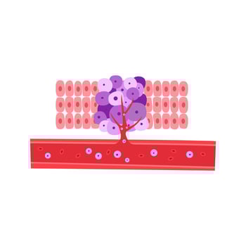 cancer cell vessel. cancer disease concept vector