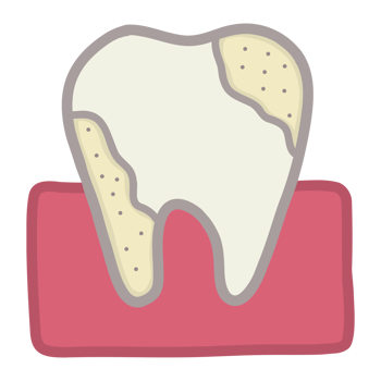Tooth with a crack png