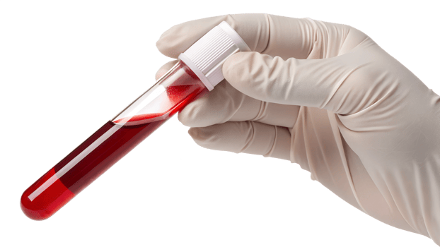 Medic carefully handles blood sample png