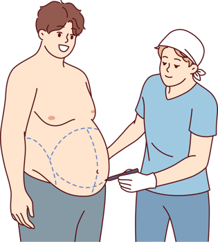 Preparation for liposuction for fat man who wants to get rid of excess weight and saggy belly. Guy visits surgeon for liposuction and abdominoplasty to get attractive body without effort png
