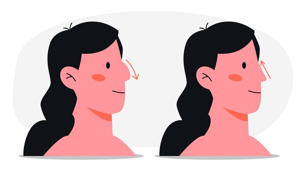 Woman Nose Job Surgery Rhinoplasty Before After. vector