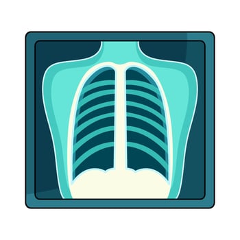 illustration of XRay vector