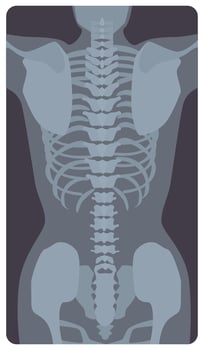 Anterior radiograph of human rib cage and pelvis. X-ray picture or radiographic image of bones and joints, front view. Medical diagnostics. Monochrome illustration in flat cartoon style vector