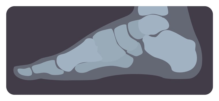 Lateral radiograph of human foot or limb. X-ray picture or radiographic image of metatarsus bones and toes, side view. Modern medical radiography. Monochrome illustration in flat cartoon style vector