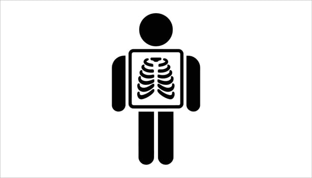 X-Ray Human Icon. Medical Radiology Silhouette. Chest Scan Illustration vector