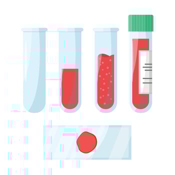 Set of test tubes with blood sample. Blood analysis. Biochemical, laboratory analysis. vector