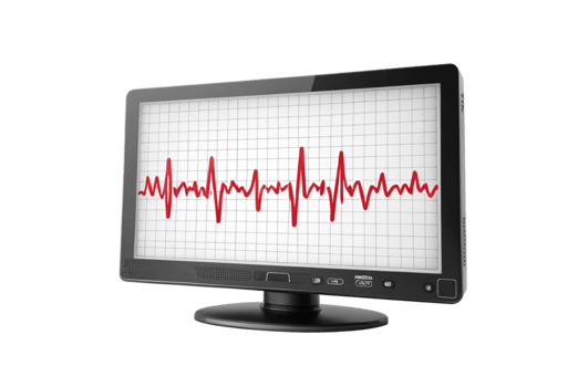 Medical Monitor with Heartbeat Pattern Detects Heart Variations png