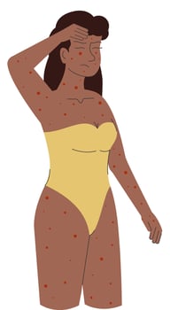 Woman suffering from seasonal virus illustration. Monkeypox virus concept. Pandemic illustration vector