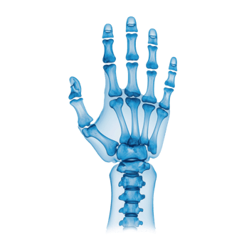 X ray of a human hand and wrist bones. Medical illustration of skeletal anatomy for healthcare and science. png