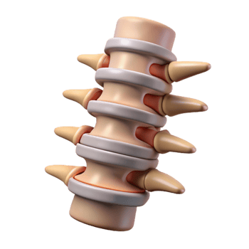 dramatic modern Fractured Spine Isolated with Twisted Bones authentic png