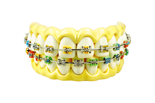 Colorful Orthodontic Braces on a Model of Human Teeth png