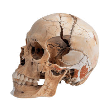 Realistic Human Skull Model with Cracks and Detailed Texture for Educational Purposes png