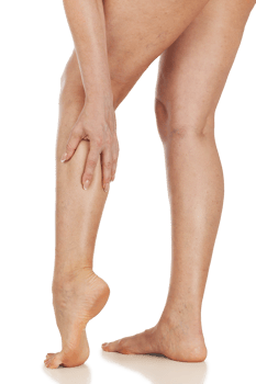 Female legs with the vascular stars on the skin, isolated. Woman touches her shin with her hand png