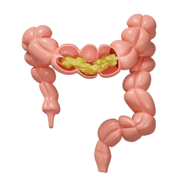 3d human colon cross section with waste in the intestine isolated. check colon health, constipation concept, 3d illustration render png