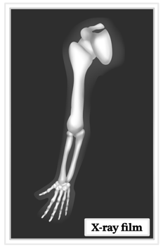 X-ray film of human arm bone png