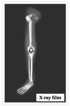 X-ray film of human leg bone png