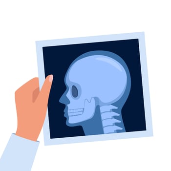 X-ray shot of skull, human body, head and neck bones side view, radiography. Roentgen shot in doctors hand vector