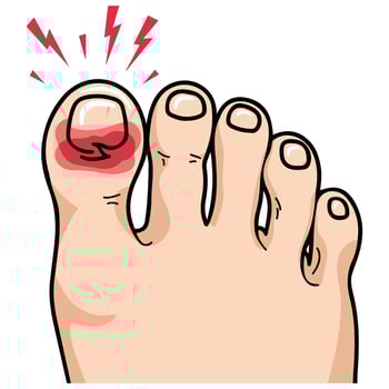 swollen inflamed big toe cartoon style isolated illustration on white background vector