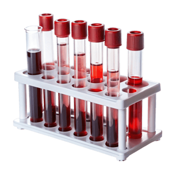 Laboratory blood test kit with multiple tubes for medical sample collection on Transparent Background png