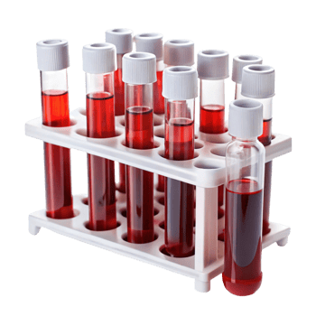 Rack of blood samples in test tubes isolated on Transparent Background for lab analysis and healthcare png