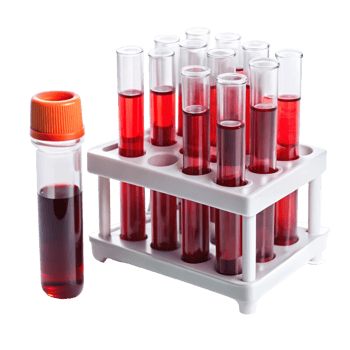 Medical diagnostic blood test tubes in a rack, isolated on white, used for clinical analysis png