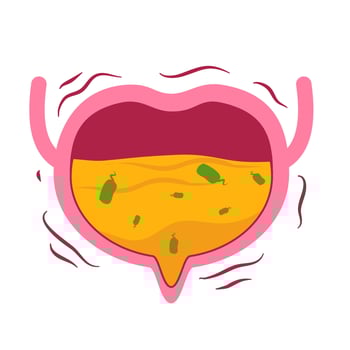 Urinary tract infection illustration. Bladder infection. vector