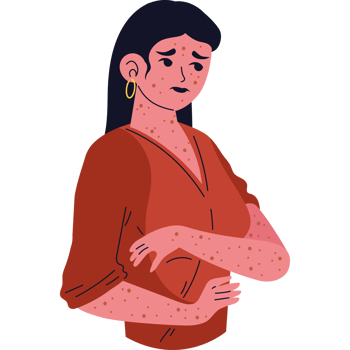 woman with monkey pox virus png