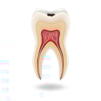 Illustration of human tooth structure showing cavity and nerves with detailed anatomy on white background for dental health education and awareness with copy space. vector
