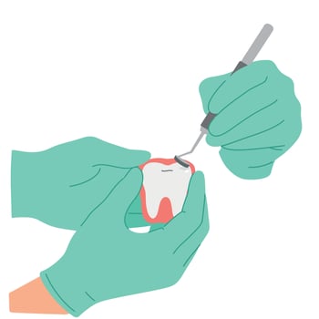 Dental Care Procedure with Gloved Hands and Dental Tool Cleaning Tooth Illustration vector