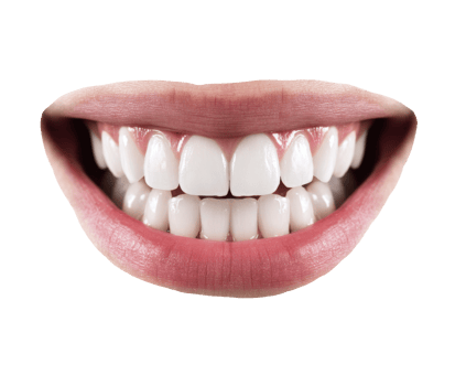 Bright and healthy smile with perfect white teeth for dental care png