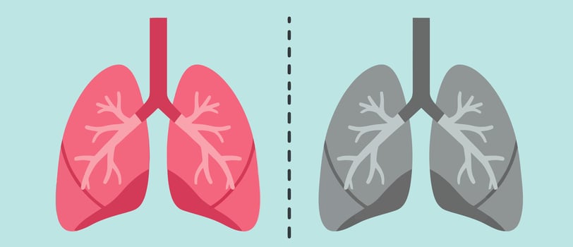 Healthy vs unhealthy lungs illustration. vector